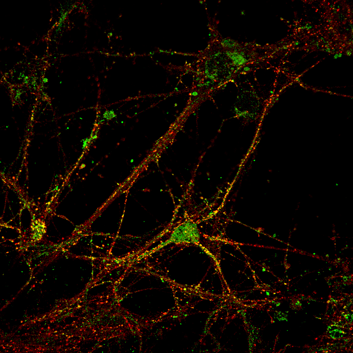 SIM image of hippocampal mouse neuron. NR1 subunit of the NMDA receptor labeled with ATTO 532 and Homer labeled with ATTO 647N.